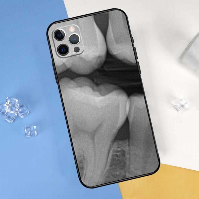 Dentist Dental Dent Tooth Phone Case For iPhone 16 Pro 15 Pro 11 13 14 Pro Max 12 Mini XR 16 15 Plus 16e Cover Shell