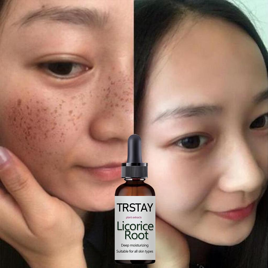 Black Spots Remove Repair Aging Whitening Serum Skin Removal Moisturizing Wrinkles Oil