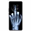 For Honor Magic8 5G 2025 Phone Case 6.58" Tiger Lion Cats Soft TPU Black Silicone Back Cover For Honor Magic 8 Fundas Shockproof