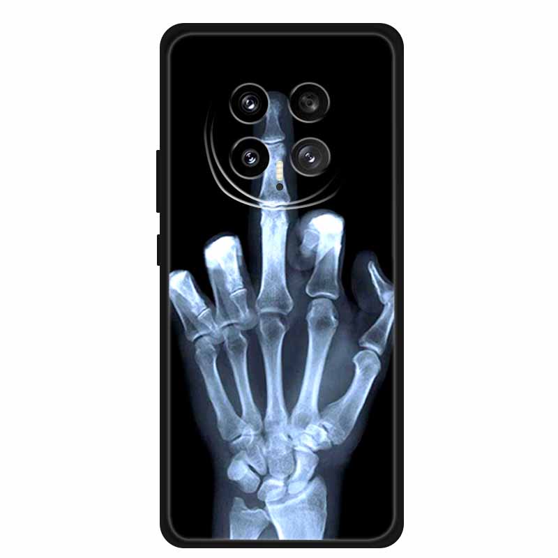 For Honor Magic8 5G 2025 Phone Case 6.58" Tiger Lion Cats Soft TPU Black Silicone Back Cover For Honor Magic 8 Fundas Shockproof