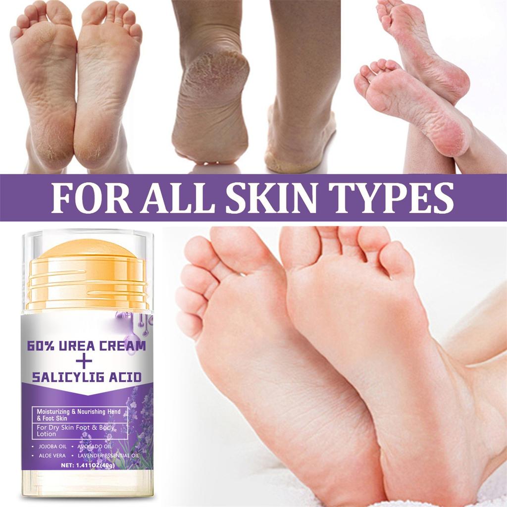Urea Cream 60% For Cracked Heels And Hands, Foot Moisturizer For Calluses, Rough Skin On Feet, Elbows, Knees, 40g