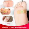 Corns Patch Reduces Corns, Calluses, Spines, Plantar s, Corns Ointment, Corns Ointment, Toe Corns Remover, Foot Calluses Health Patch.