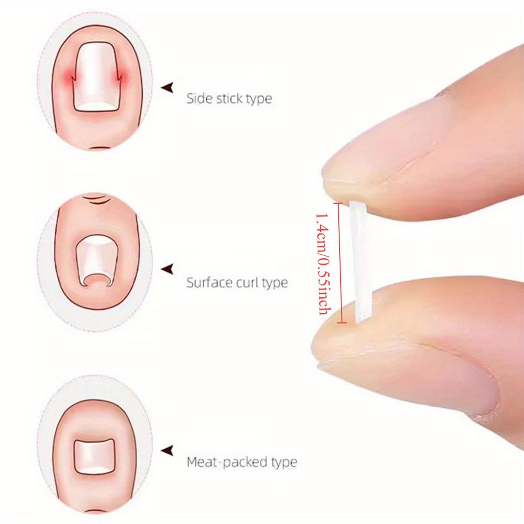 10Pcs Toenail Straightening Clippers Toenail Correction Tools Set Nail Care Elastic Stickers Pedicure Foot Care Tools