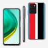 Milan Stylish Stripe Design Phone Case For Redmi 12 13C 12C 15C 15 9 Power 10 Prime+ 10C 10A 9T 9C 9i 9AT 9A Sport A5 K50 K30 60