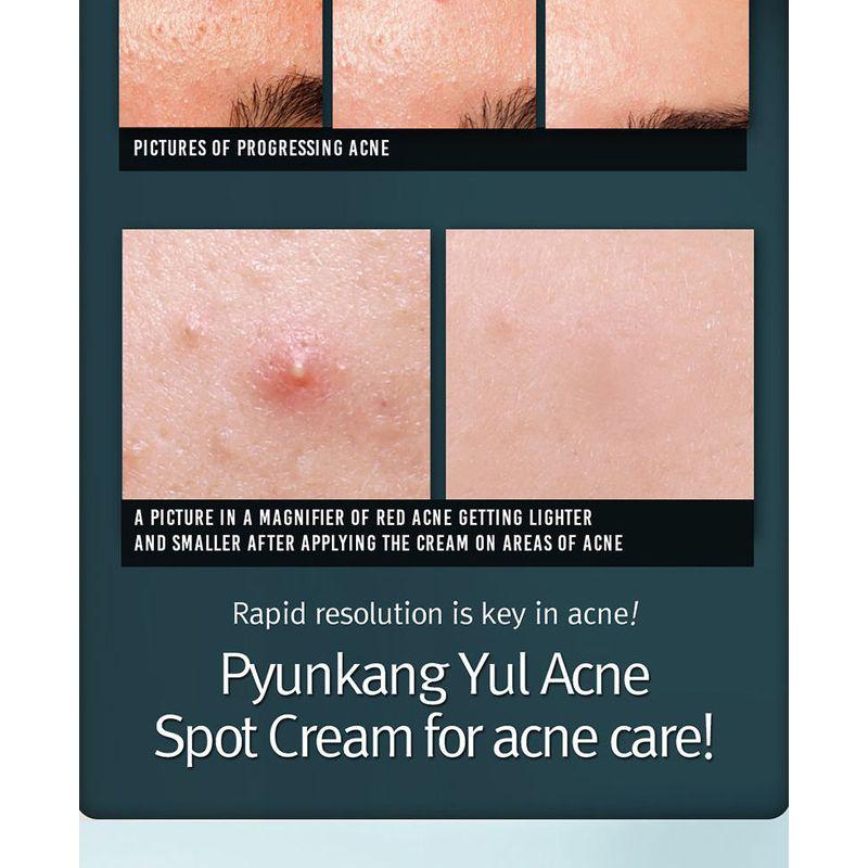 Pyunkang Yul - Acne Spot Cream 15ml
