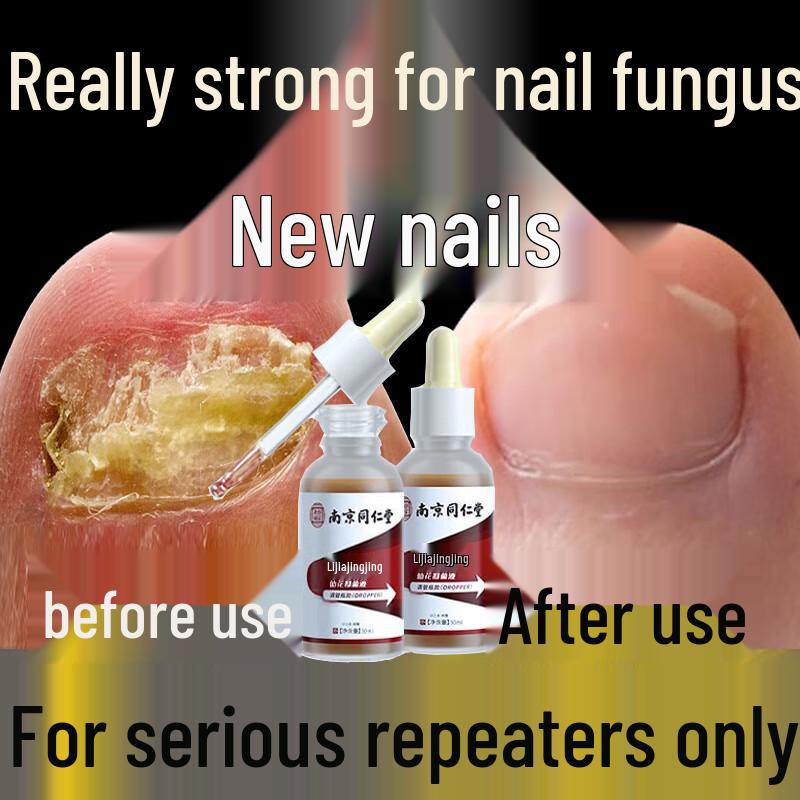 Tong Ren Tang Fungal Nail Repair Solution