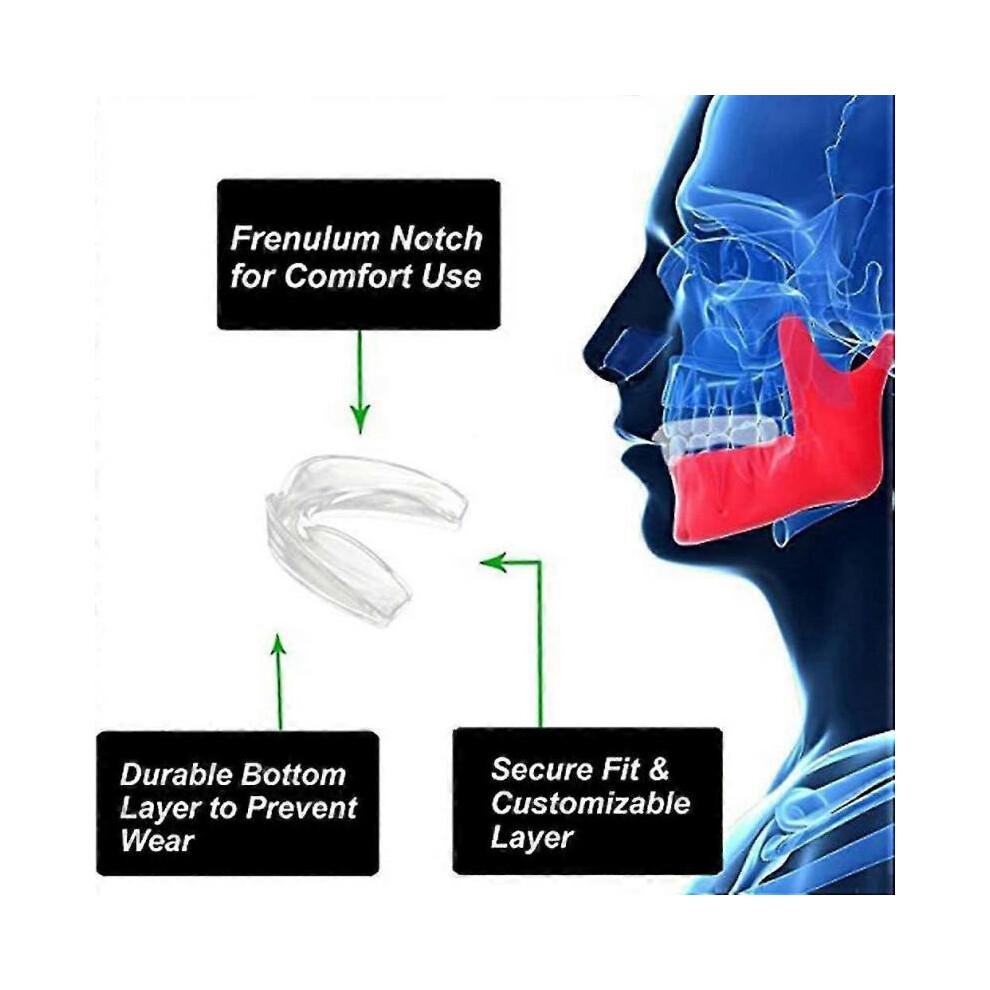 Mouth Guard for Teeth Grinding-teeth Grinding Guard Night Guard Teeth Grinding for Adults Stops Bruxism 4pcs