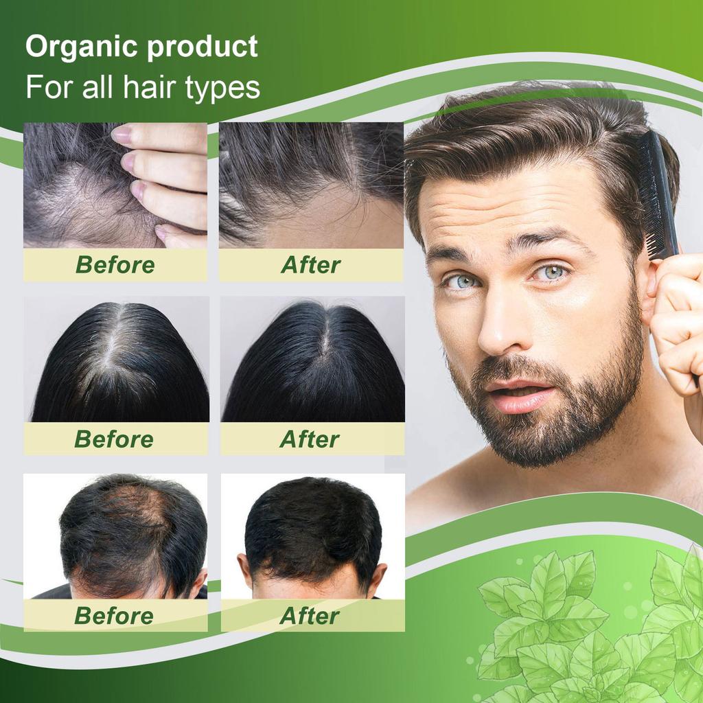 Lotion Capillaire au Gingembre, Solution Nutritive Rafraîchissante et Nourrissante pour le Cuir Chevelu et la Racine des Cheveux, Spray Fortifiant et Épaississant