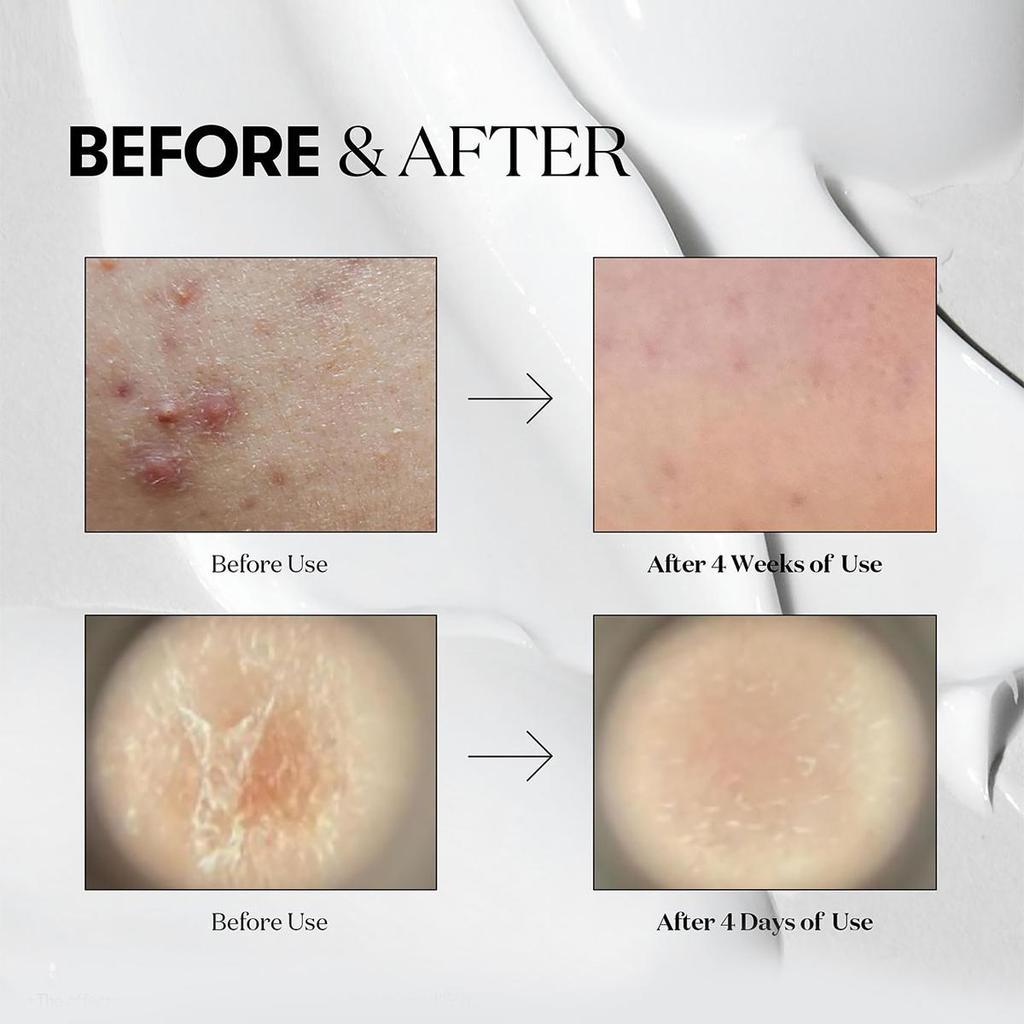 VT KOSMETYKI CICA Reedle Shot 50 shot100  50ml/1.69fl.oz