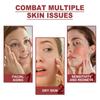 Set Membrane al Collagene Carta Maschera Viso Solubile Adesivo per Guance Patch per la Fronte Patch per Attenuare le Linee del Sorriso Rassodante Skincare