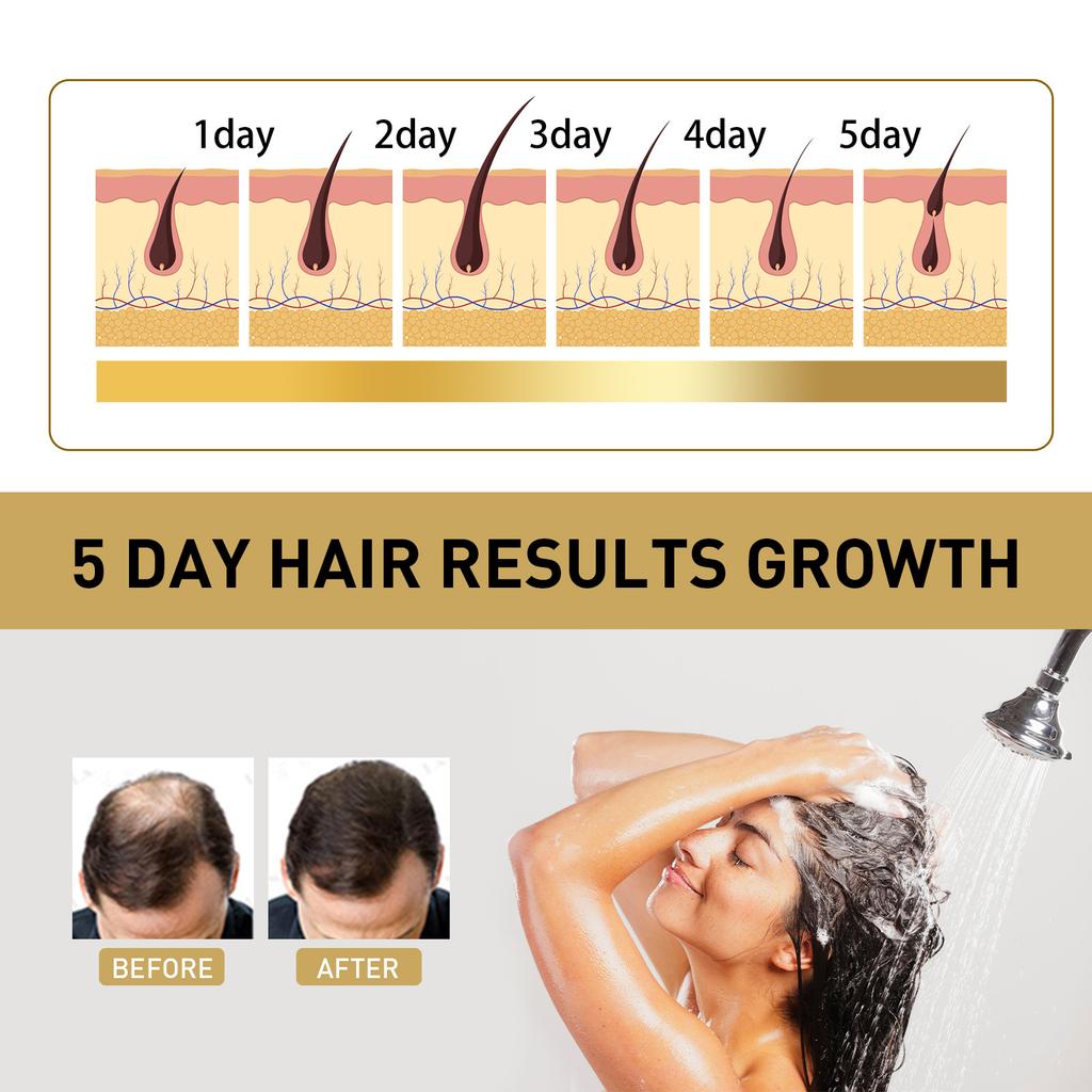 Shampooing Repousse Gingembre Contrôle Huile Anti Chute de Cheveux Antipelliculaire Hydrate Nourrit Cuir Chevelu Réparation Cheveux Abîmés Shampooing Croissance
