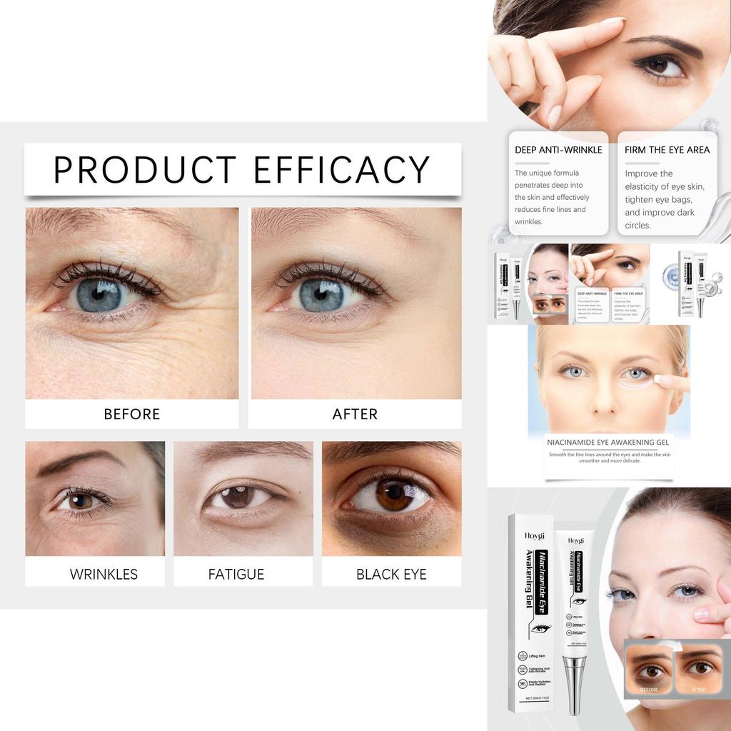 Hoygi Niacinamide Eye Gel Hydrating Nourishing Firming Skin Care Moisturizing Cream