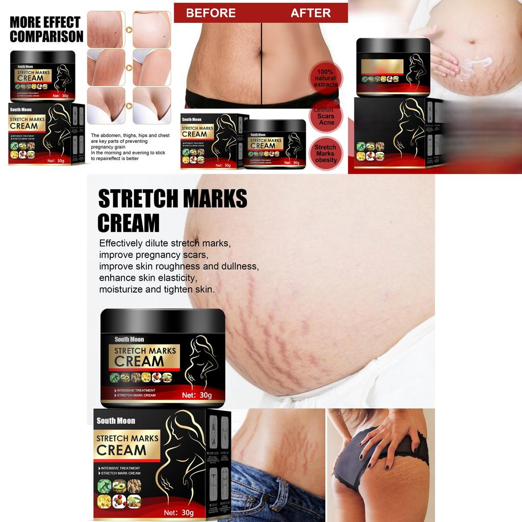 South Moon Scar Repair Cream Tightens Skin And Reduces Postpartum Scars