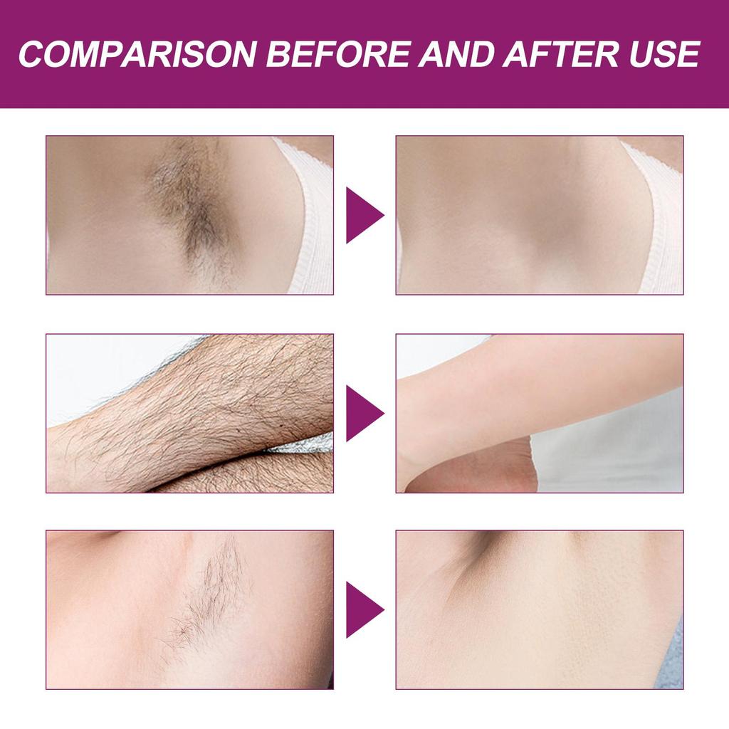 Hair Removal Spray, Gentle & Painless Hair Removal Mousse Spray for Underarms, Arms, Legs & Full Body