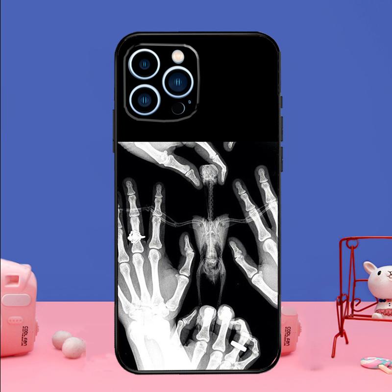 xray art aesthetic Skull Phone Case For iPhone 16 15 14 13 12 11 17 Pro Max Plus 12 13 mini 16e 17 Air Bumper Cover