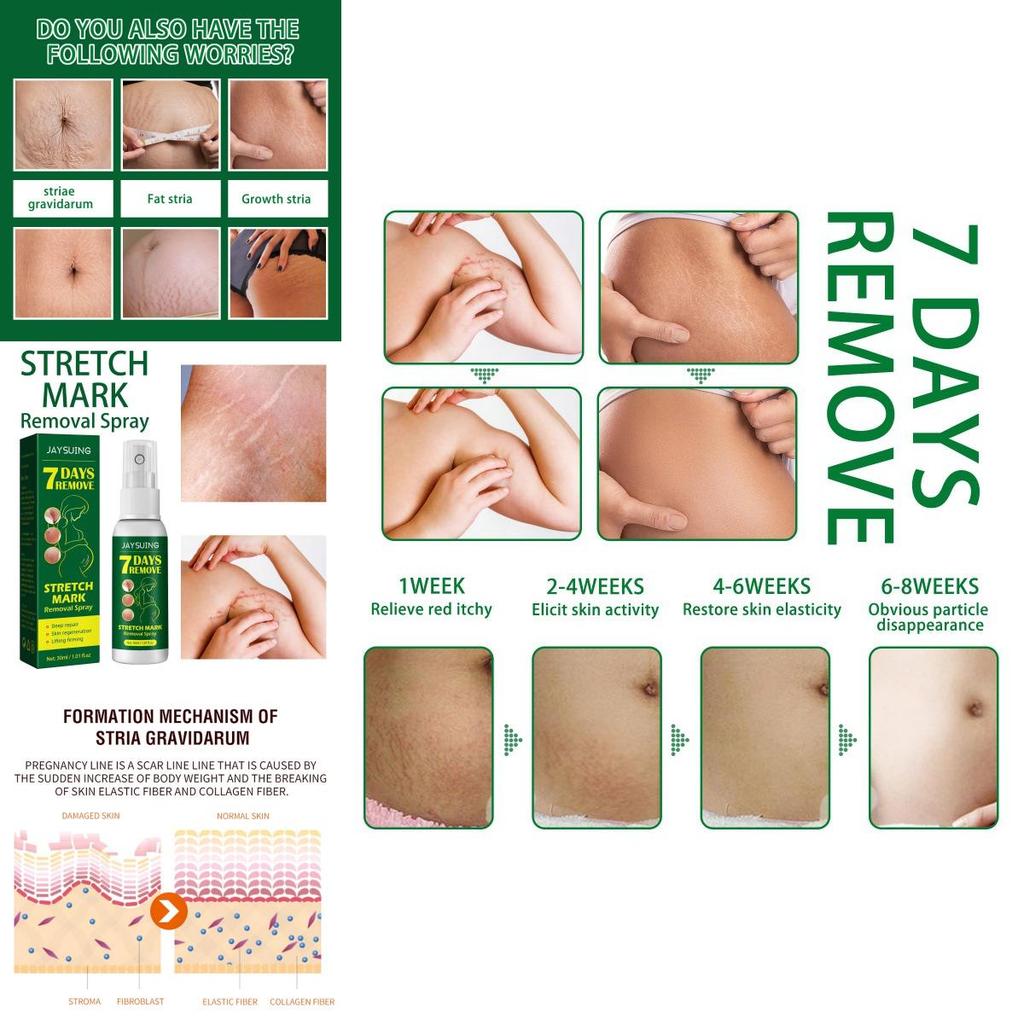 Jaysuing Skin Care Spray For Postpartum Skin Firming And Fine Line Reduction In 30ml Packaging