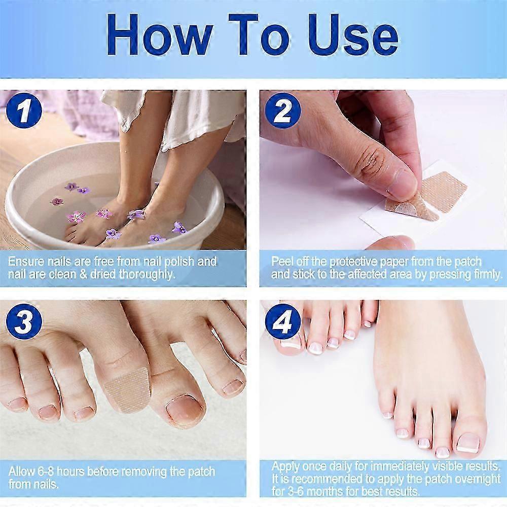120Pcs Toenail Fungus Patch Breathable Nail Repair Patches Nail Repair Stickers Waterproof Sticky for Discolored Or Damaged Nails