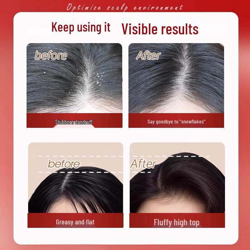 Miss Lilly Anti-Dandruff Refreshing Shampoo