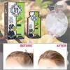 Ginger Hair Growth Essential Oils Serum Fast Hair Regrowth Anti-loss Repair Damaged Hair Strong The Root of Hair Care