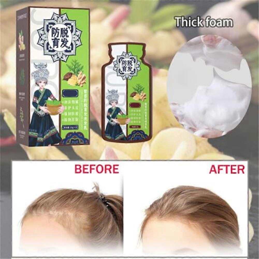 Ginger Hair Growth Essential Oils Serum Fast Hair Regrowth Anti-loss Repair Damaged Hair Strong The Root of Hair Care