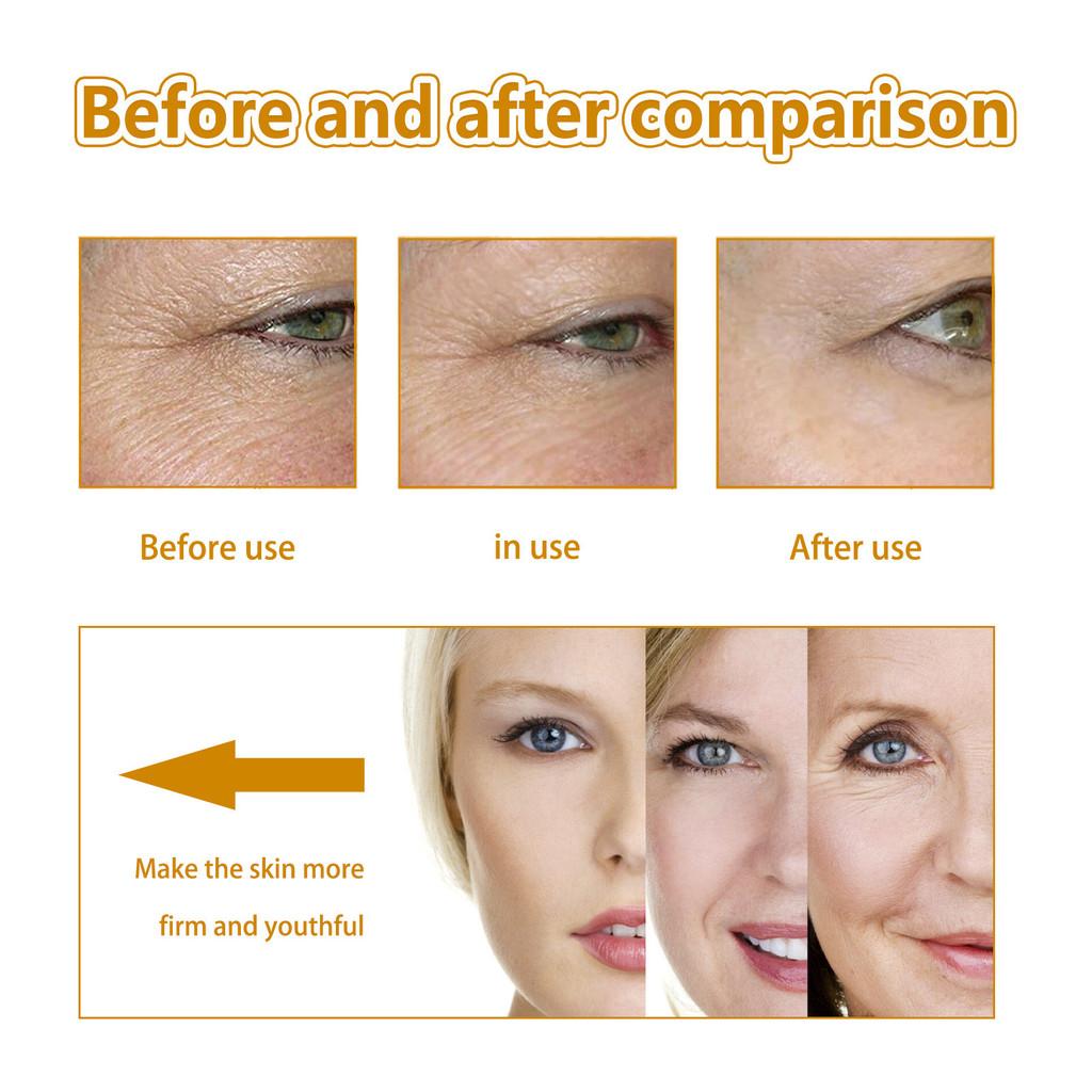 Hoygi Collagen Anti-aging Essence For Hydrating And Firming Facial Skin 30ml