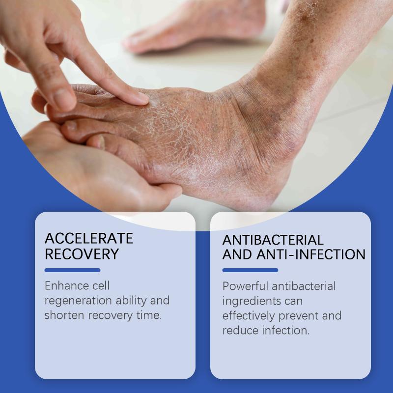 20g Body care cream with gentle ingredients to care for and moisturize the skin, soothing dryness