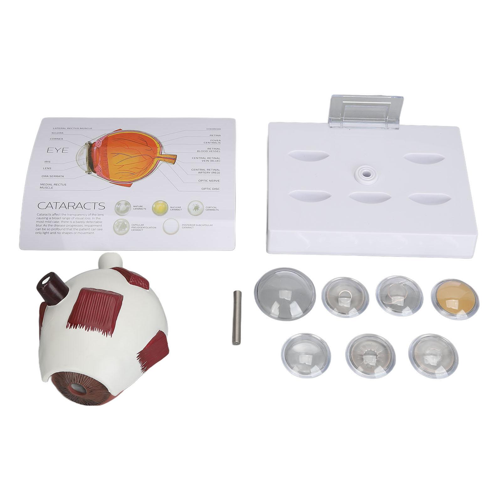 

Модель человеческого глазного яблока Реалистичные детали Многокомпонентная Прочная Образовательная Точная Демонстрация Модель анатомии глаза Увеличенная для демонстрации белый