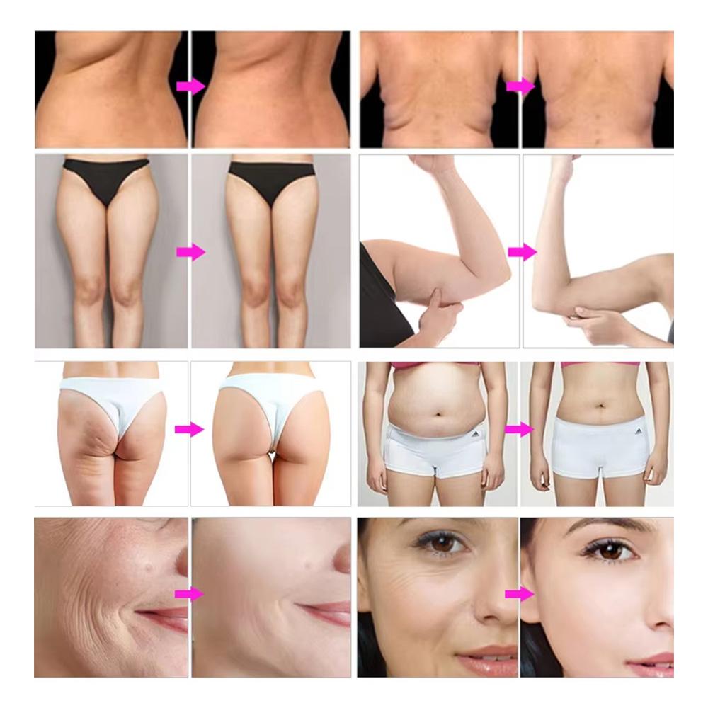 5 IN 1 40k/80k Ultrasonic Cavitation Machine RF Vacuum Body Shaping System Beauty Salon Professional Equipment