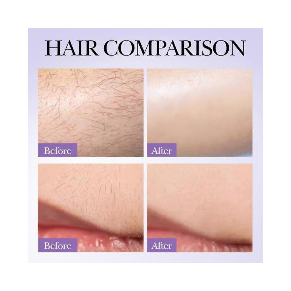 Haarentfernungscreme + Haarwuchshemmer-Spray + Erdbeer-Vanille After-Shave-Öl für Frauen für glatte Haut, schmerzfreie und sanfte Haarentfernung Beruhigend &
