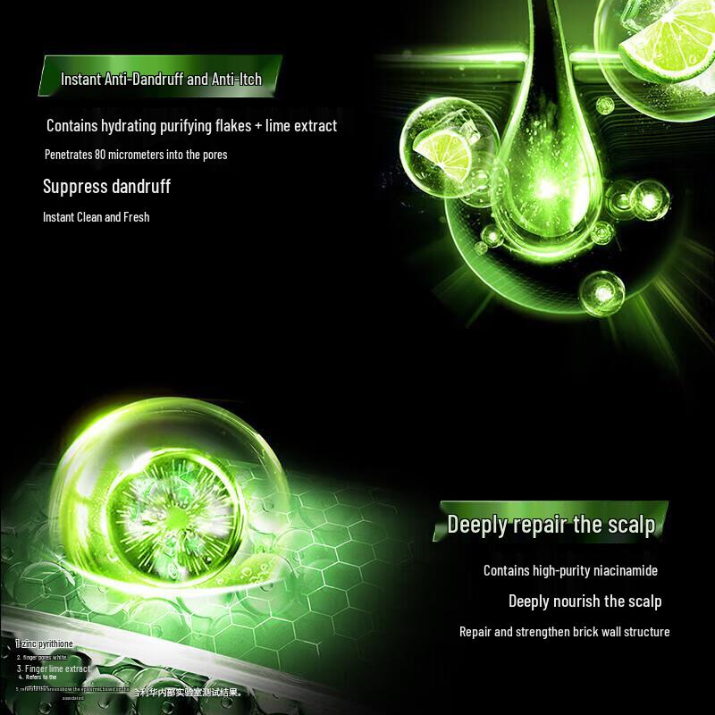 Clear Anti-Dandruff & Oil Control Scalp Care Shampoo