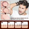 OUHOE Ginger Hair Growth Essence 6ml, Universal Hair Treatment, Moisturizing & Repairing, Strengthens Hair Roots, Anti-Hair Loss