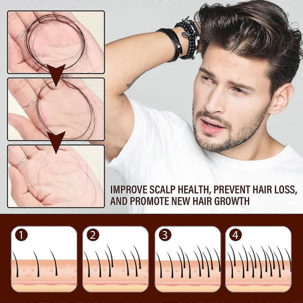 OUHOE Ginger Hair Growth Essence 6ml, Universal Hair Treatment, Moisturizing & Repairing, Strengthens Hair Roots, Anti-Hair Loss
