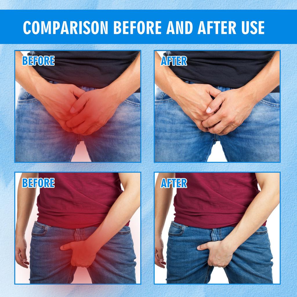 Soothing Men's Skin Itch Relief Cream For Inner Thighs Gentle Moisturizing Formula