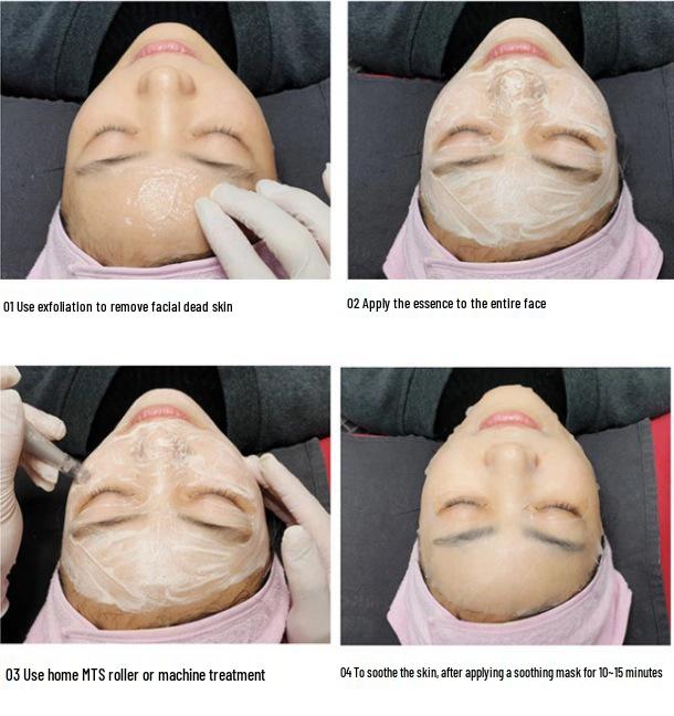 BB Glow Korean Semi-Permanent MTS Microneedle Foundation: Multi-Color Options
