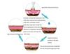 SPA Use Cold Plasma Pen Ozone Acne Remover Wrinkle Removal Skin Rejuvenation Sterilization Anti-inflammation Beauty Instrument