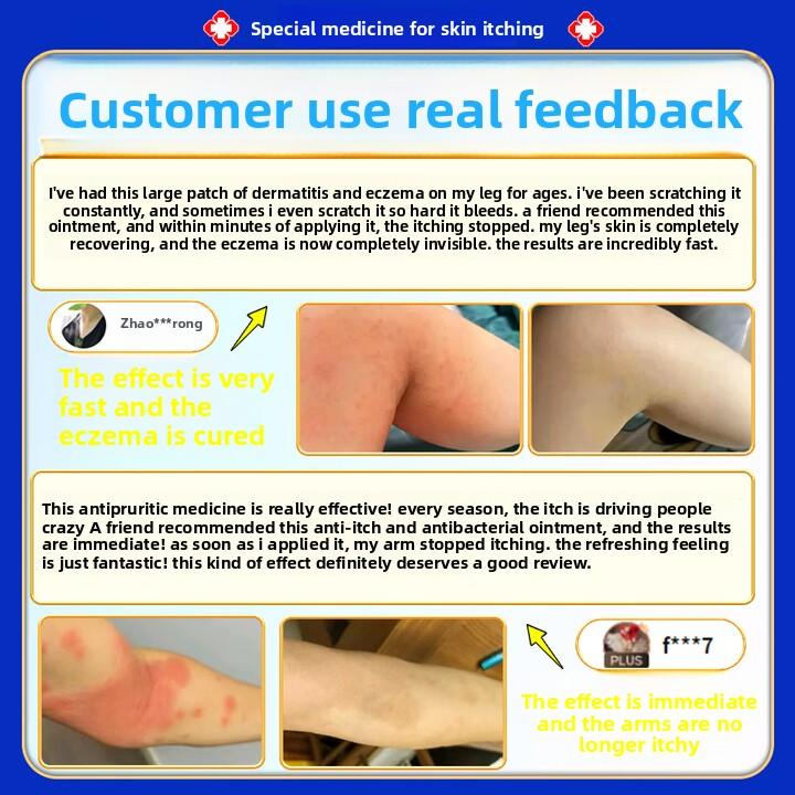 Anti-Itch Cream 50g Large Size, Fast Relief for Eczema, Fungal, Dermatitis & Skin Rashes, Antiseptic