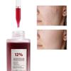 Fruit Salicylic Exfoliating Blackhead Acne Scar Acne Shrink Pores Moisturizing 35ML