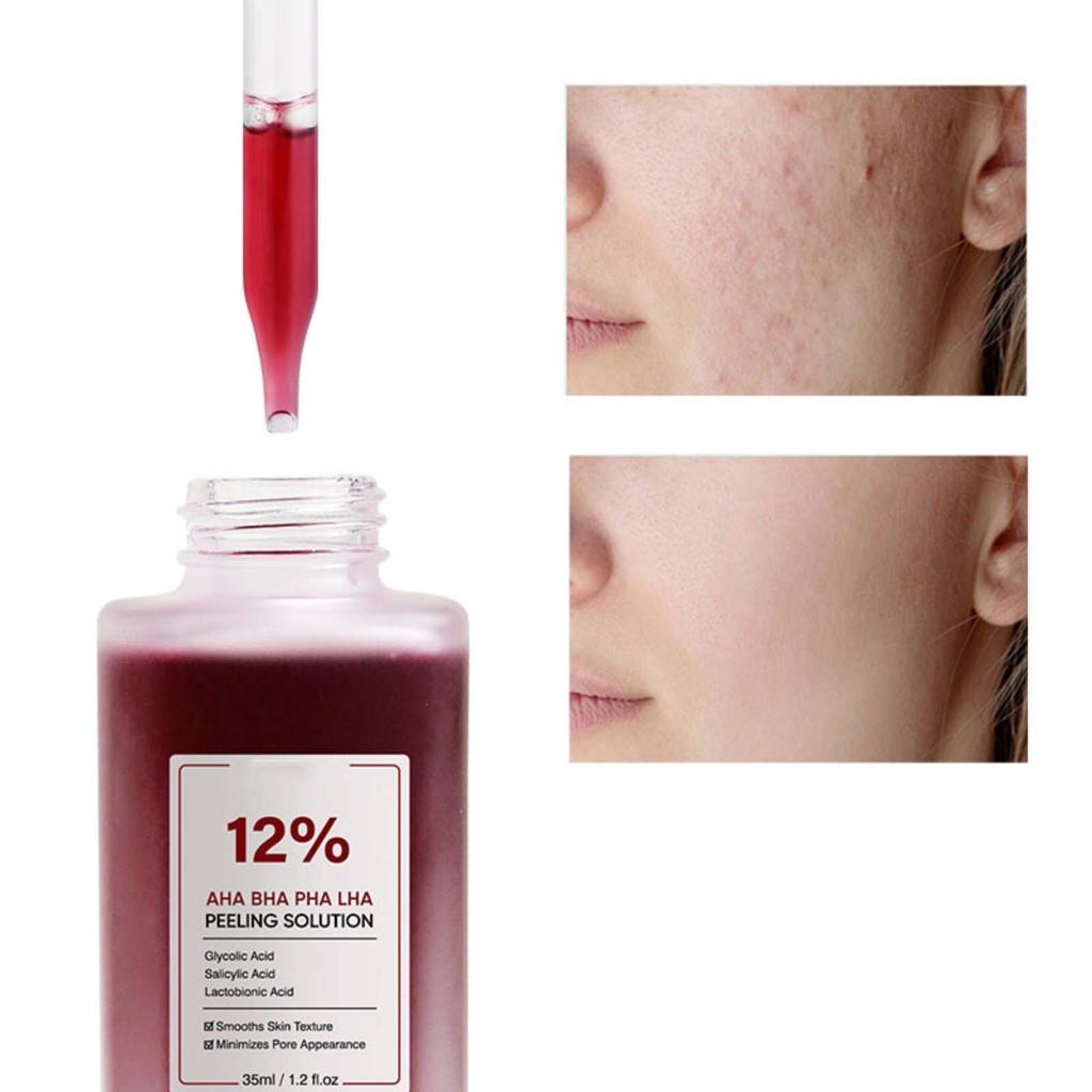 Fruit Salicylic Exfoliating Blackhead Acne Scar Acne Shrink Pores Moisturizing 35ML