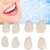 70PCS/Bag Teeth Veneers Resin Anterior Upper Temporary Crown For Dental Oral Care