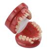 Dental Lab Teeth Malocclusion Model Demonstration Model for Training Studying Teaching Oral Model Dentistry Tools