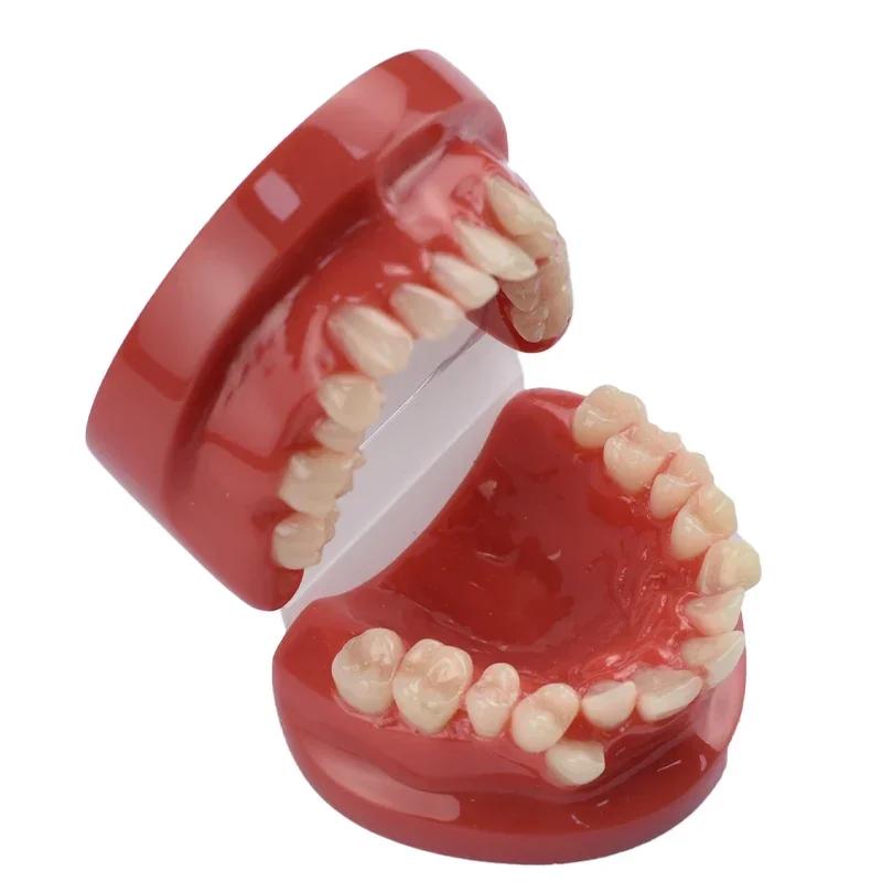Dental Lab Teeth Malocclusion Model Demonstration Model for Training Studying Teaching Oral Model Dentistry Tools