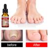 10ml Nail Essence Absorption Protect Fast Painless Reduce Dry Quick Effect Onychomycosis Heal