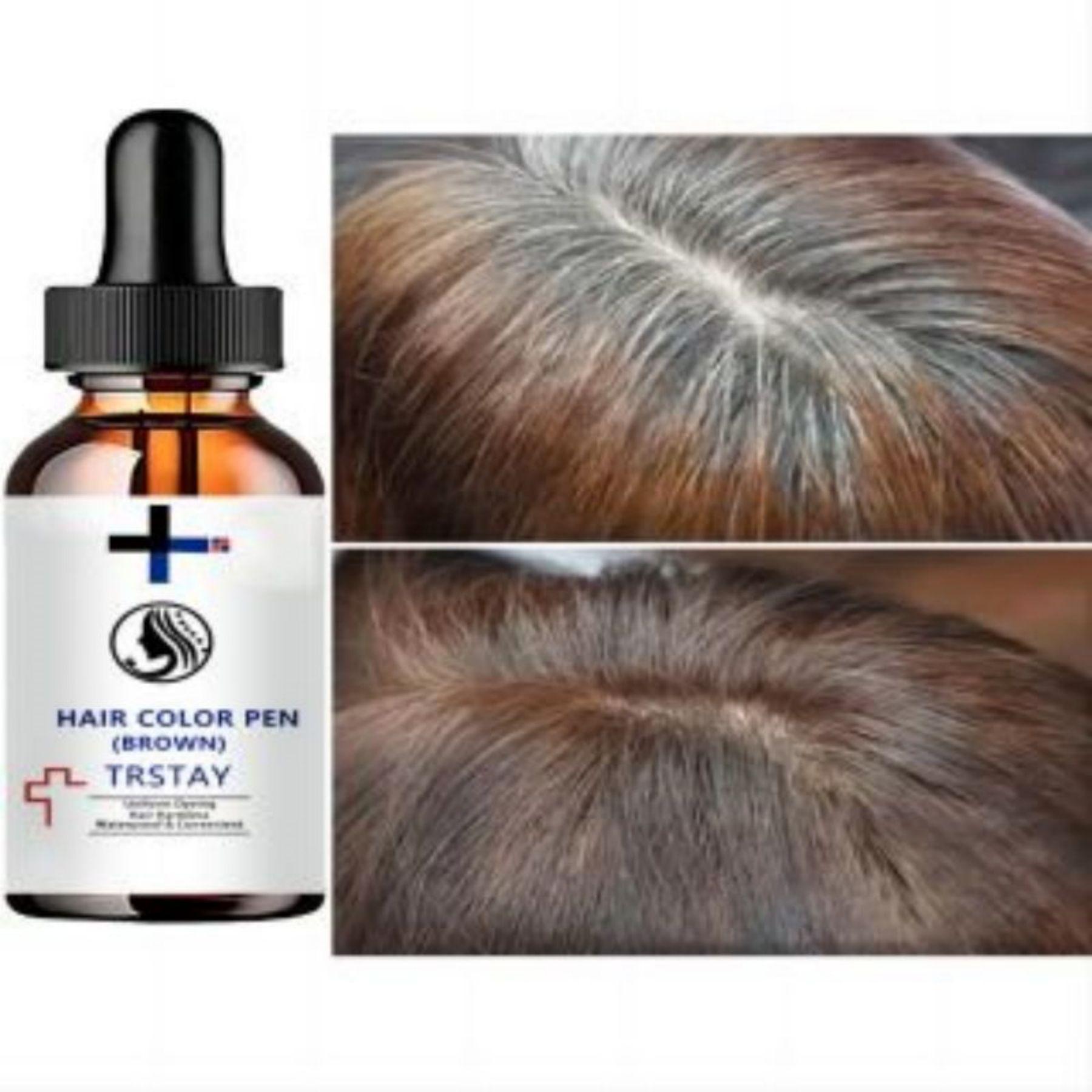 

Масло-эссенция для волос 5 Натуральное имбирное масло для волос против выпадения волос, лечение облысения, быстрый питательный уход за кожей головы