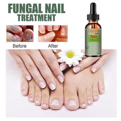 Onycho Nail Repair Product for Hands and Feet, Suppressing Nail Thickening