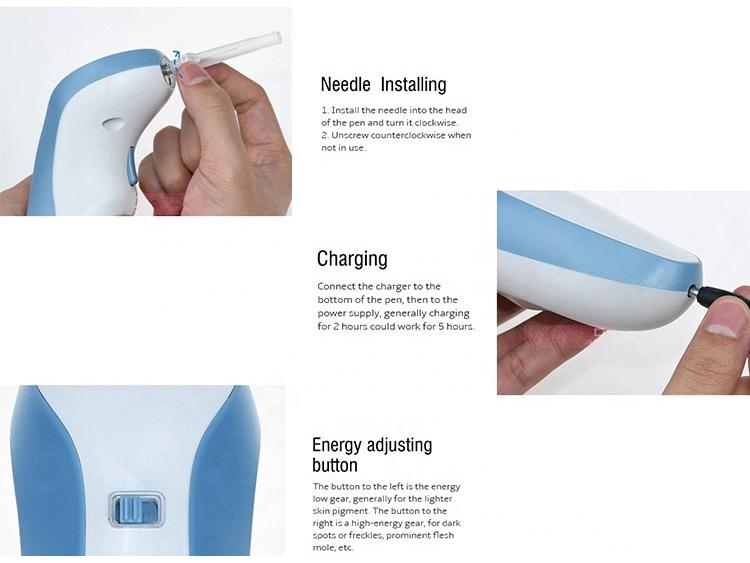 Rechargeable Magic Pen for Freckle & Mole Removal - Plasma Beauty Device with Magnetic Levitation