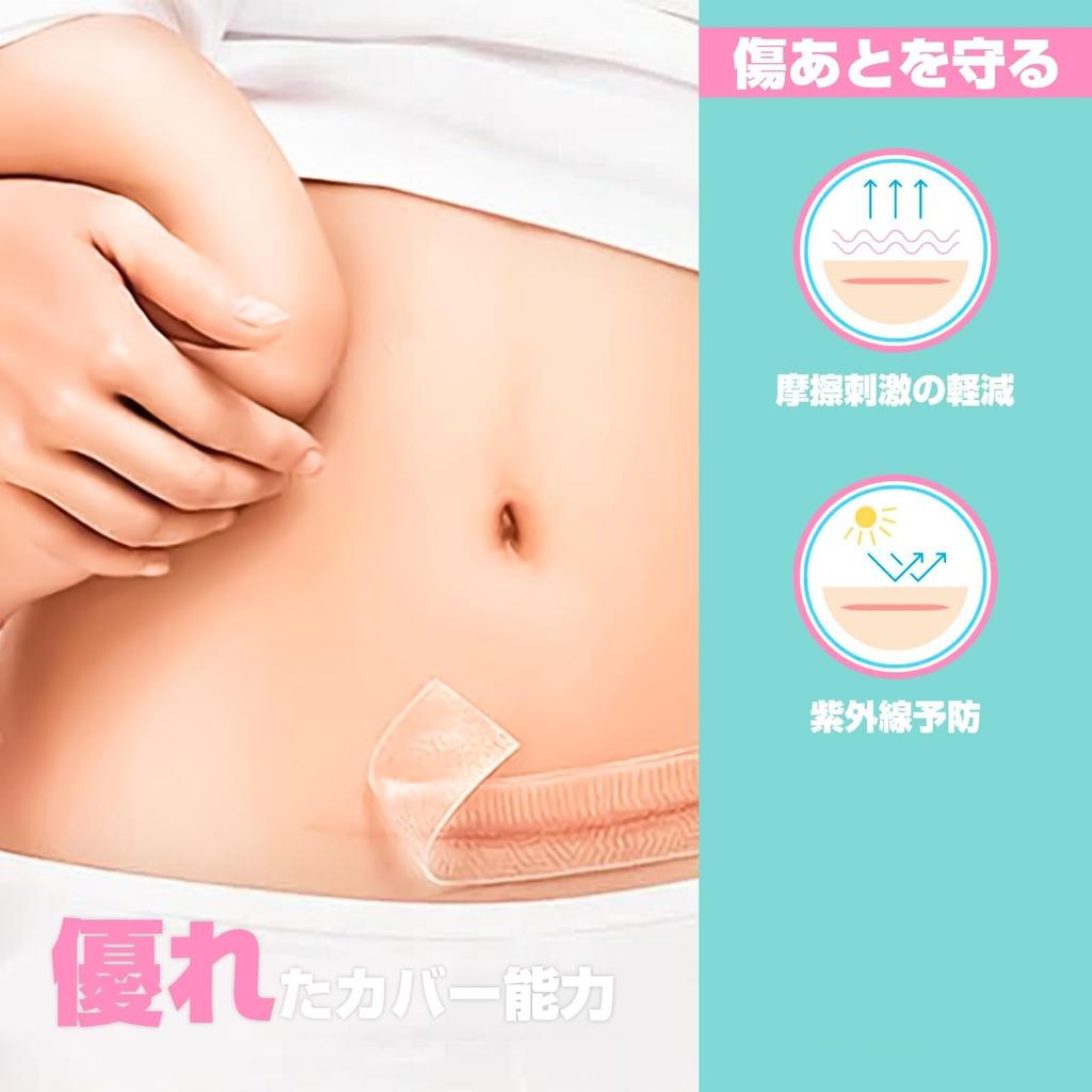 CMD Scar Care Tape, Keloid Tape, 4cm x 150cm, Cesarean Section Scar Care, Scar Concealment, Silicone Gel Sheet, Skin Color (2 Rolls)