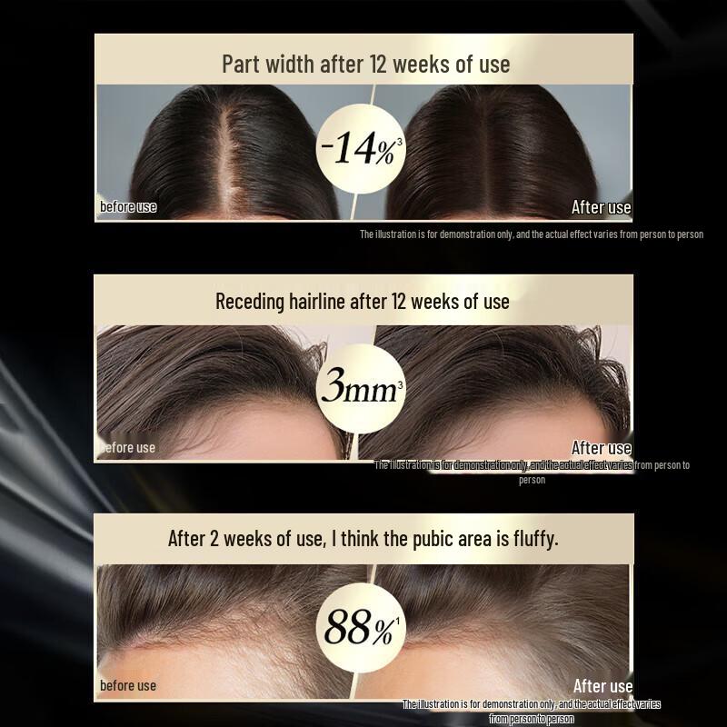 Schwarzkopf Anti-Haarausfall Stärkendes Shampoo 400ml