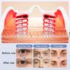 Eye Massage Device Eye Care Lifting Tightening Dark Circles Eye Bag Removal
