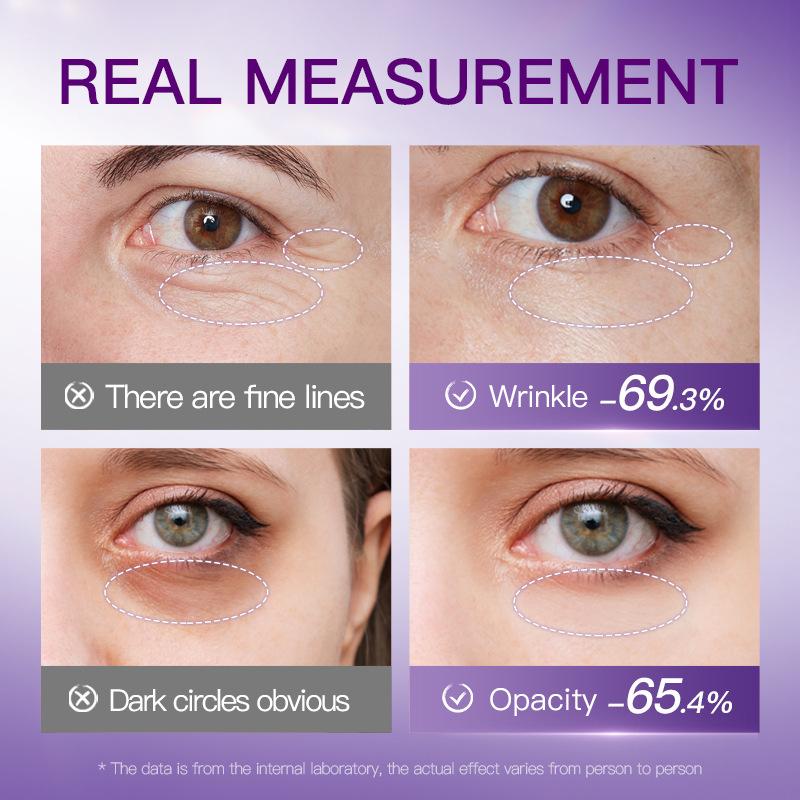 Eyes Bag Remove Collagen Eye Patch Instant Fade Fine Line Dark Circles Fat Particles Anti-Puffiness Snake Venom Peptide Freeze-dried Eye Mask