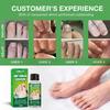 Hbesty Herbal Nail Fungus Treatment Liquid For Effective Foot Care And Healing